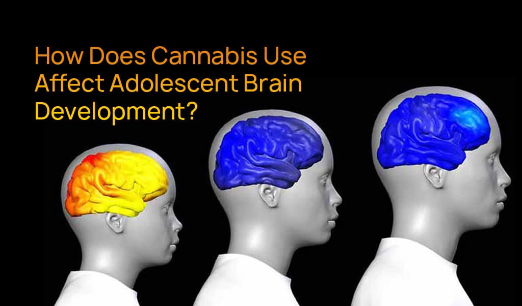 How Does Cannabis Use Affect Adolescent Brain Development?